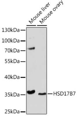 Western Blot: HSD17B7 AntibodyAzide and BSA Free [NBP3-15527]