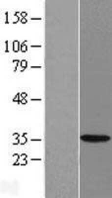 Western Blot: HSD17B7 Overexpression Lysate [NBP2-07042]