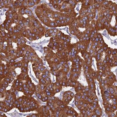 Immunohistochemistry-Paraffin: HSD17B8 Antibody [NBP1-84309]