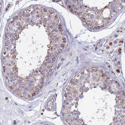 Immunohistochemistry-Paraffin: HSD17B8 Antibody [NBP1-84309]