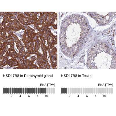 Immunohistochemistry-Paraffin: HSD17B8 Antibody [NBP1-84309]