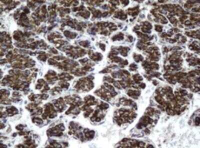 Immunohistochemistry: HSD17B8 Antibody (OTI2E12) - Azide and BSA Free [NBP2-71350]