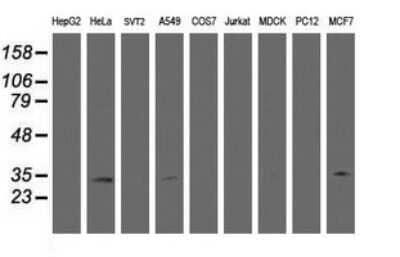 Western Blot: HSD17B8 Antibody (OTI2E12)Azide and BSA Free [NBP2-71350]