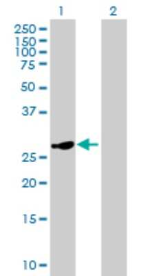 Western Blot: HSD17B8 Antibody [H00007923-B01P]