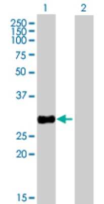 Western Blot: HSD17B8 Antibody [H00007923-B02P]