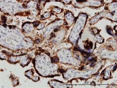Immunohistochemistry-Paraffin: HSD3B1 Antibody (3C11-D4) [H00003283-M01]