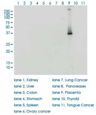 Western Blot: HSD3B1 Antibody (3C11-D4) [H00003283-M01]