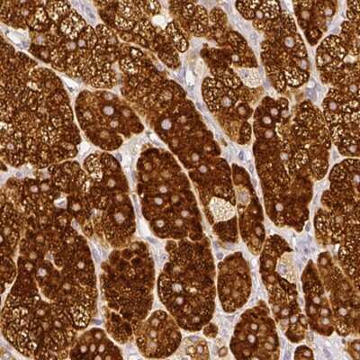 Immunohistochemistry-Paraffin: HSD3B1 Antibody [NBP2-33385]