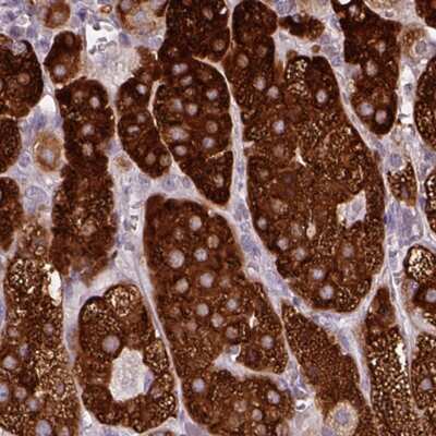 Immunohistochemistry-Paraffin: HSD3B1 Antibody [NBP2-33386]