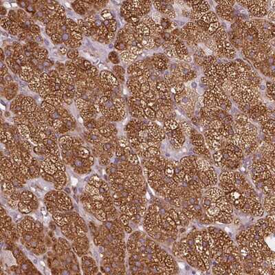 Immunohistochemistry-Paraffin: HSD3B1 Antibody [NBP2-46700]