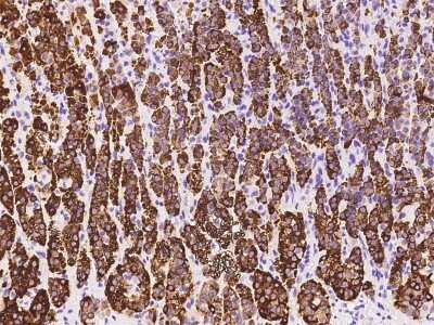 Immunohistochemistry-Paraffin: HSD3B1 Antibody [NBP2-99334]