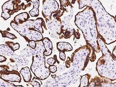 Immunohistochemistry-Paraffin: HSD3B1 Antibody [NBP2-99334]