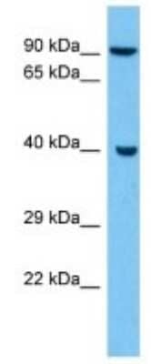 Western Blot: HSD3B1 Antibody [NBP3-10203]