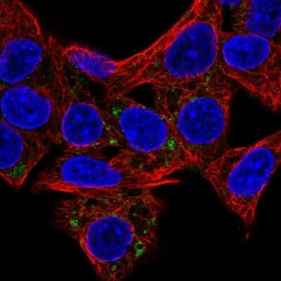 Immunocytochemistry/ Immunofluorescence: HSD3B7 Antibody [NBP2-56368]