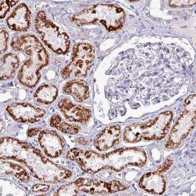 Immunohistochemistry-Paraffin: HSD3B7 Antibody [NBP2-14103]