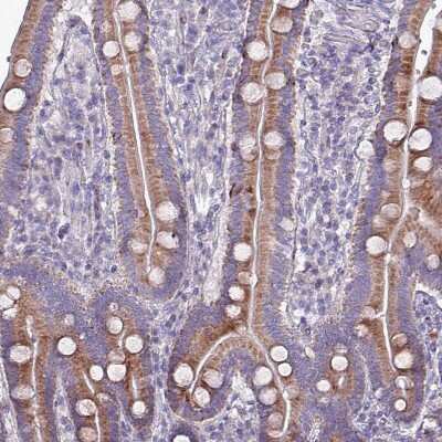 Immunohistochemistry-Paraffin: HSD3B7 Antibody [NBP2-14103]