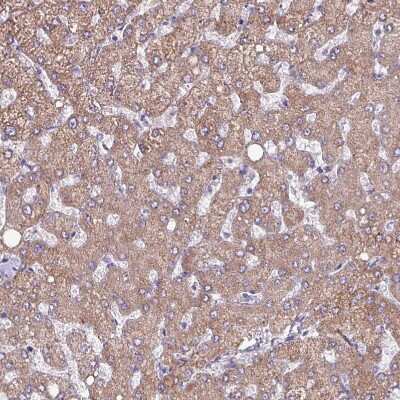 Immunohistochemistry-Paraffin: HSD3B7 Antibody [NBP2-14103]