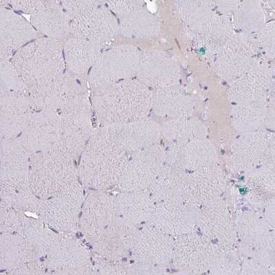 Immunohistochemistry-Paraffin: HSD3B7 Antibody [NBP2-14103]