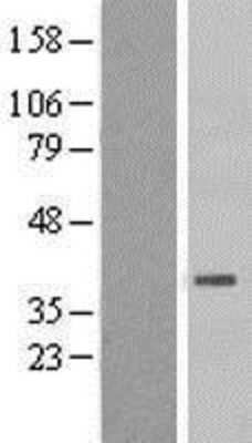 Western Blot: HSD3B7 Overexpression Lysate [NBL1-11734]