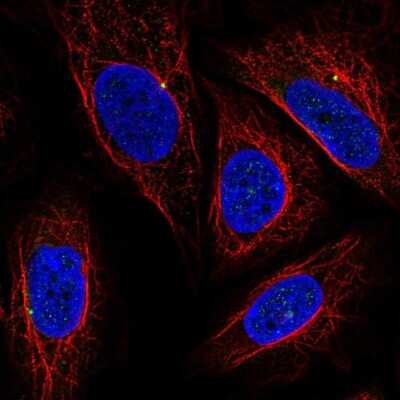 Immunocytochemistry/ Immunofluorescence: HSD5 Antibody [NBP2-58856]