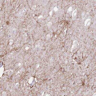 Immunohistochemistry-Paraffin: HSD5 Antibody [NBP2-14471]