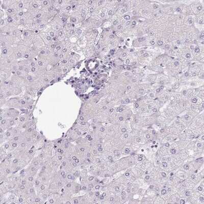 Immunohistochemistry-Paraffin: HSD5 Antibody [NBP2-14471]