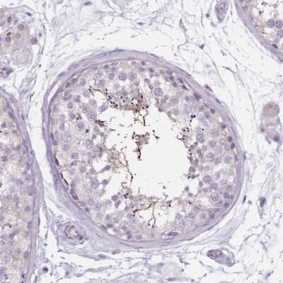 Immunohistochemistry-Paraffin: HSD5 Antibody [NBP2-14471]