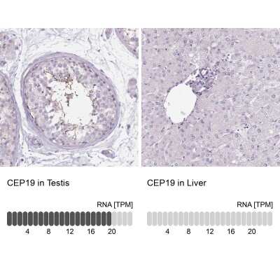 Immunohistochemistry-Paraffin: HSD5 Antibody [NBP2-14471]