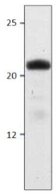 Western Blot: HSD5 Antibody [NBP3-12203]