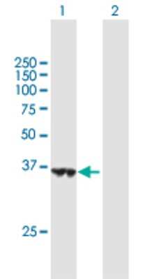 Western Blot: HSDL1 Antibody [H00083693-B01P]