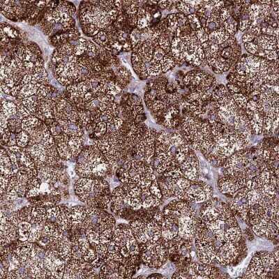 Immunohistochemistry-Paraffin: HSDL2 Antibody [NBP2-14104]