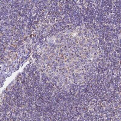 Immunohistochemistry-Paraffin: HSDL2 Antibody [NBP2-14104]