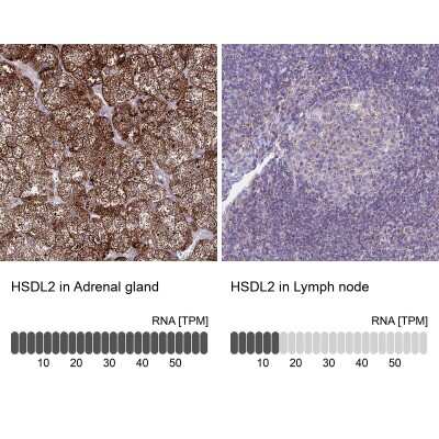 Immunohistochemistry-Paraffin: HSDL2 Antibody [NBP2-14104]