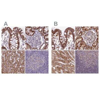Immunohistochemistry-Paraffin: HSDL2 Antibody [NBP2-14104]
