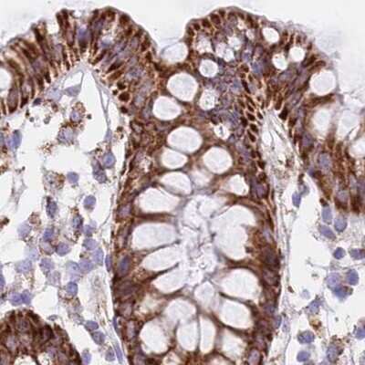 Immunohistochemistry-Paraffin: HSDL2 Antibody [NBP2-14104]