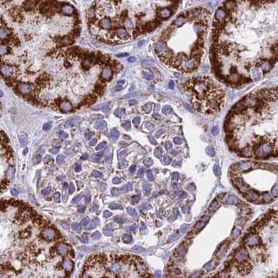 Immunohistochemistry-Paraffin: HSDL2 Antibody [NBP2-14104]