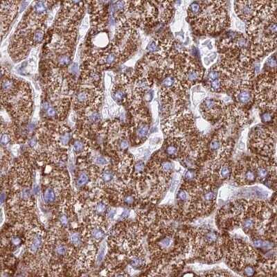 Immunohistochemistry-Paraffin: HSDL2 Antibody [NBP2-14104]