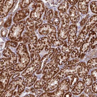 Immunohistochemistry-Paraffin: HSDL2 Antibody [NBP2-14105]