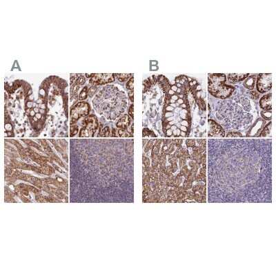 Immunohistochemistry-Paraffin: HSDL2 Antibody [NBP2-14105]