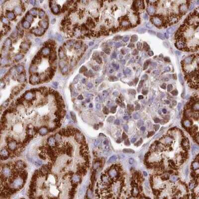Immunohistochemistry-Paraffin: HSDL2 Antibody [NBP2-14105]