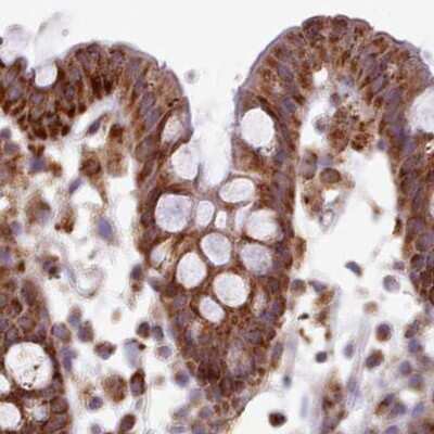 Immunohistochemistry-Paraffin: HSDL2 Antibody [NBP2-14105]