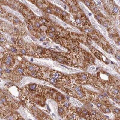 Immunohistochemistry-Paraffin: HSDL2 Antibody [NBP2-14105]