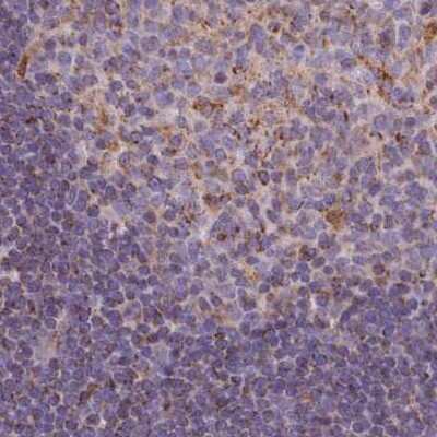 Immunohistochemistry-Paraffin: HSDL2 Antibody [NBP2-14105]