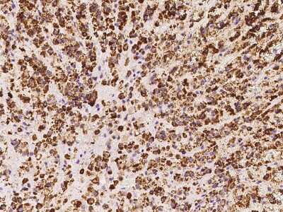 Immunohistochemistry-Paraffin: HSDL2 Antibody [NBP2-97749]