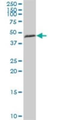 Western Blot: HSDL2 Antibody [H00084263-B01P]