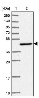 Western Blot: HSDL2 Antibody [NBP2-14105]