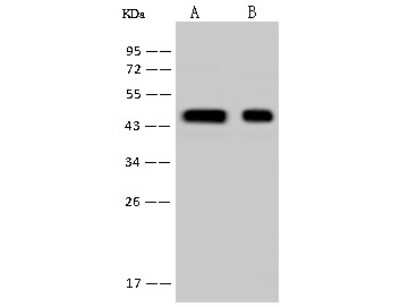 Western Blot: HSDL2 Antibody [NBP2-97749]