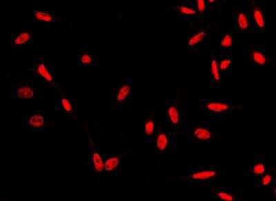 Immunocytochemistry/ Immunofluorescence: HSF1 Antibody (009) [NBP2-90081]