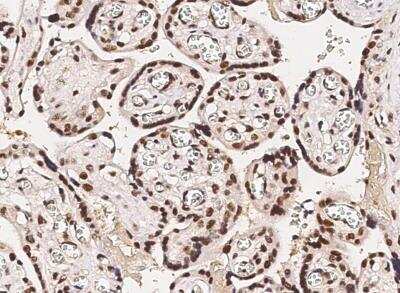 Immunohistochemistry-Paraffin: HSF1 Antibody (009) [NBP2-90081]
