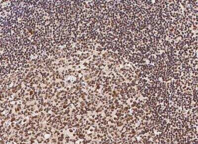 Immunohistochemistry-Paraffin: HSF1 Antibody (009) [NBP2-90081]